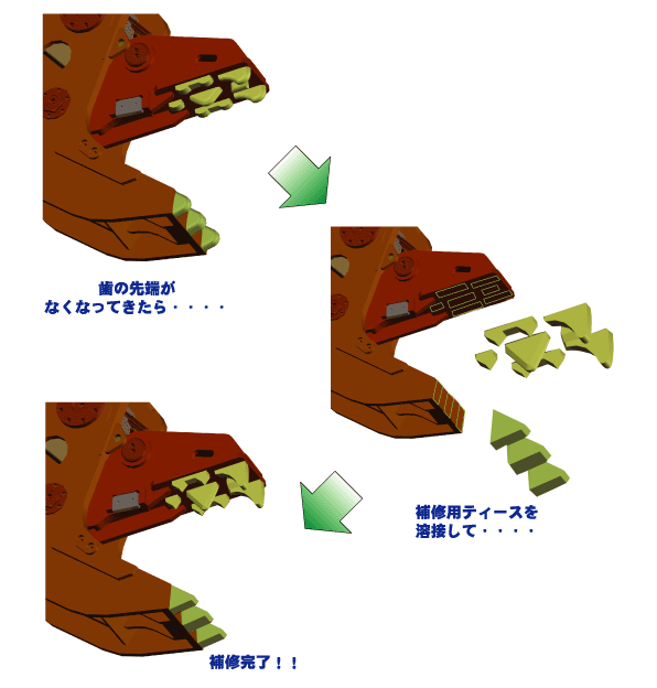 ティース交換　図